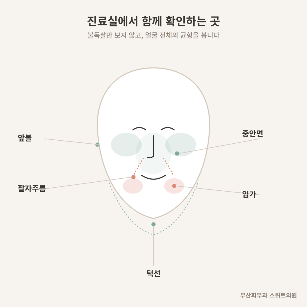불독살 진료 시 확인하는 얼굴 부위