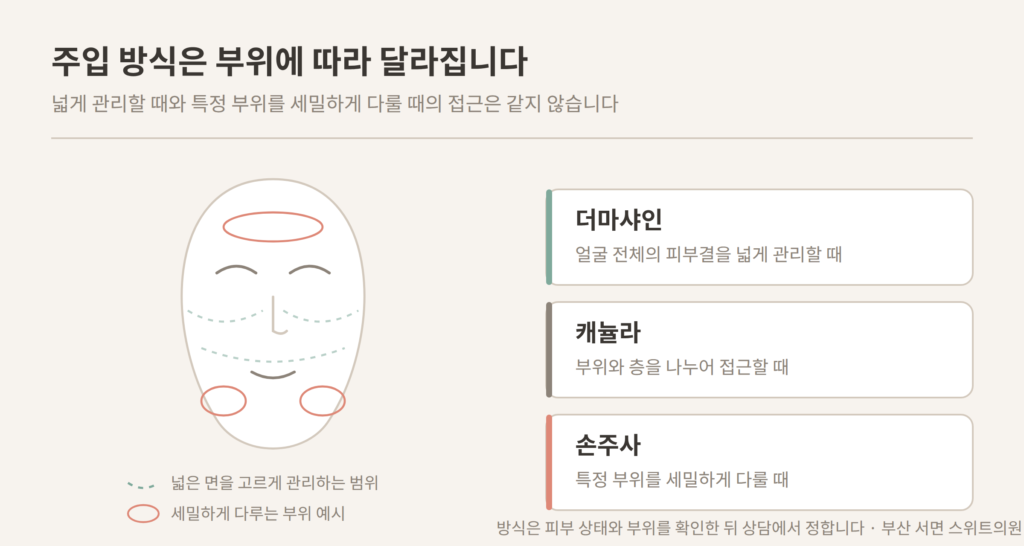 리투오 더마샤인 캐뉼라 손주사 주입 방식 비교 개념도