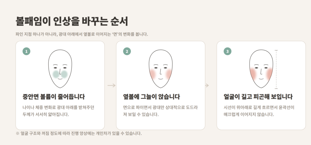 볼패임 옆볼꺼짐이 진행되는 3단계 개념도
