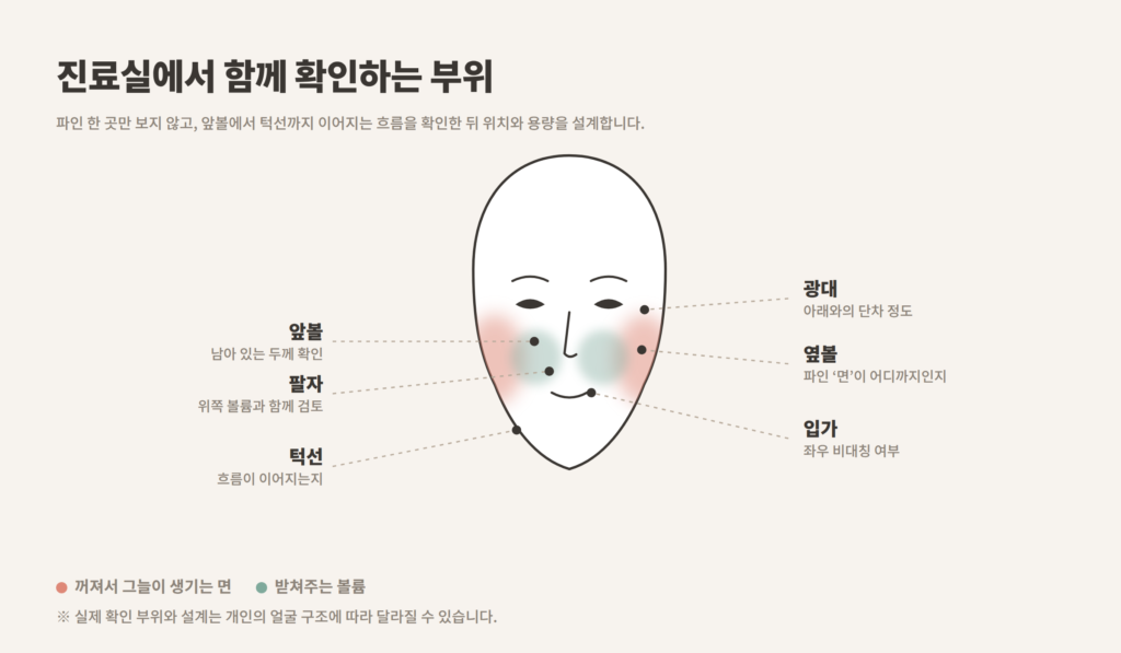 볼패임 힐로웨이브 상담에서 확인하는 앞볼 광대 옆볼 팔자 입가 턱선 부위 개념도