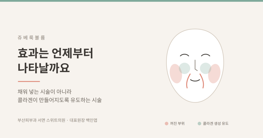 쥬베룩볼륨 효과 시기 콜라겐 생성 유도 개념도