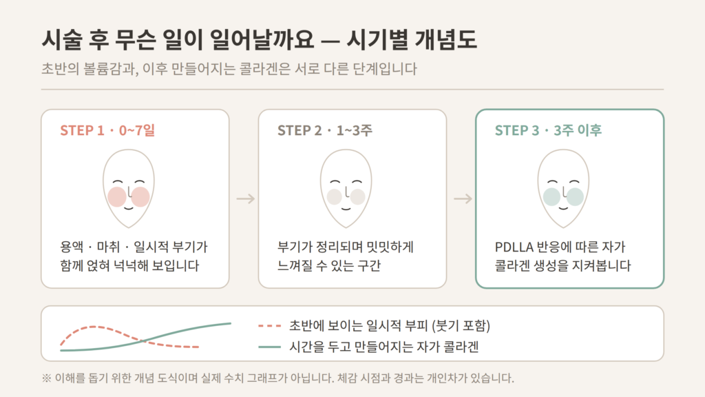 쥬베룩볼륨 시술 후 시기별 붓기와 콜라겐 생성 흐름 개념도