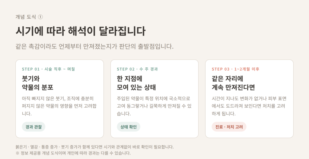 쥬베룩볼륨 시술 직후 붓기 약물 고임 1~2개월 결절 시기별 구분 도식