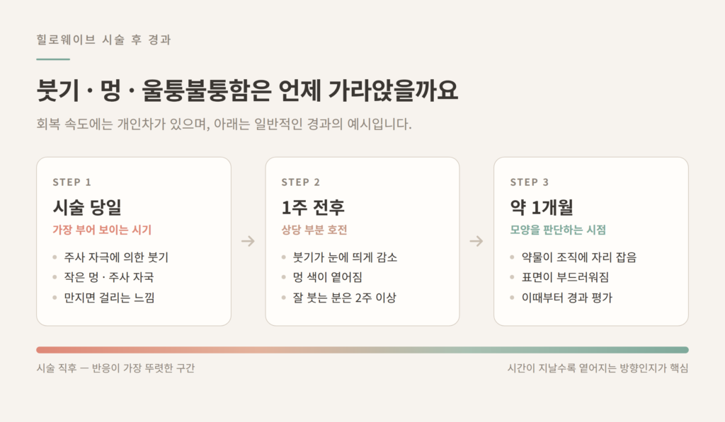 힐로웨이브 시술 후 붓기 멍 회복 경과 시술 당일 1주 1개월 단계 도식