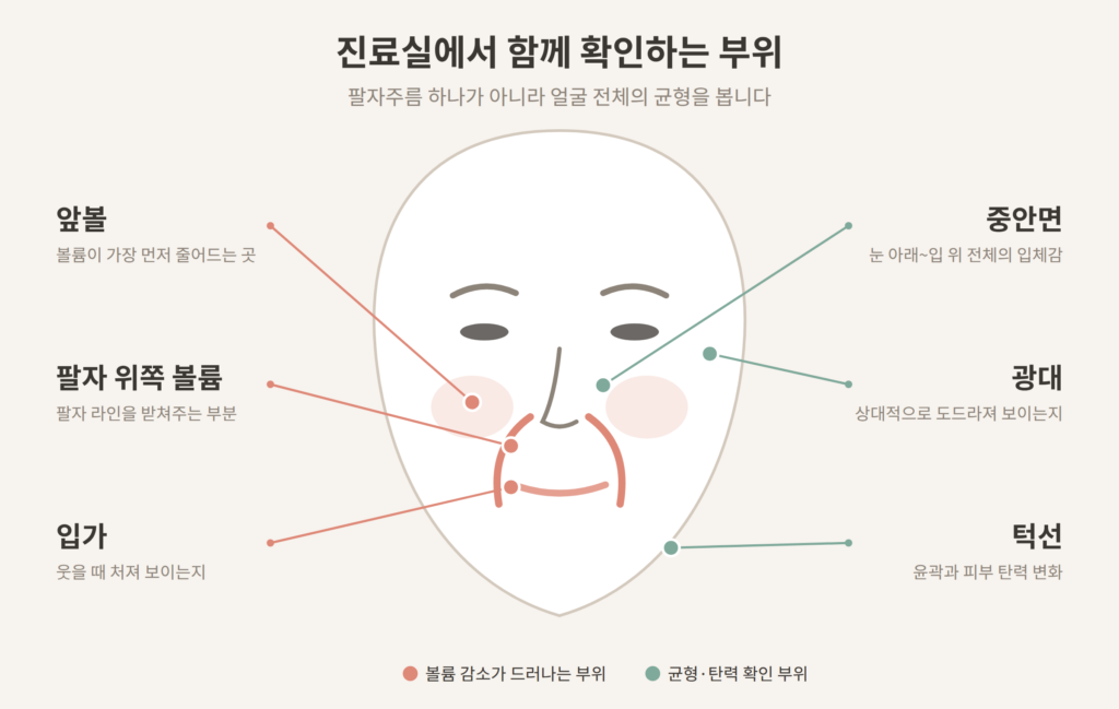 팔자주름 진료 시 확인하는 앞볼 중안면 입가 턱선 부위 도식