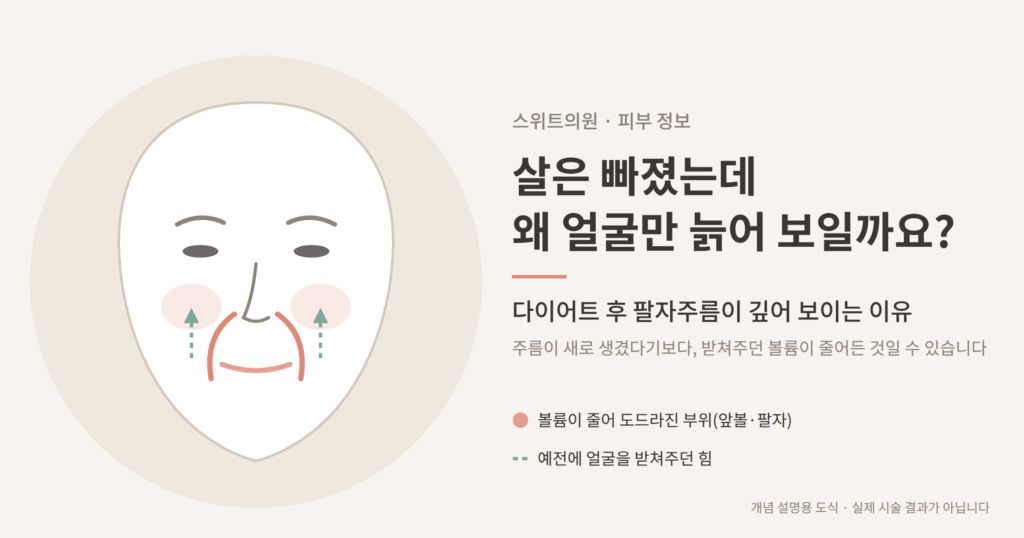 다이어트 후 팔자주름이 깊어 보이는 이유 앞볼 볼륨 감소 개념도