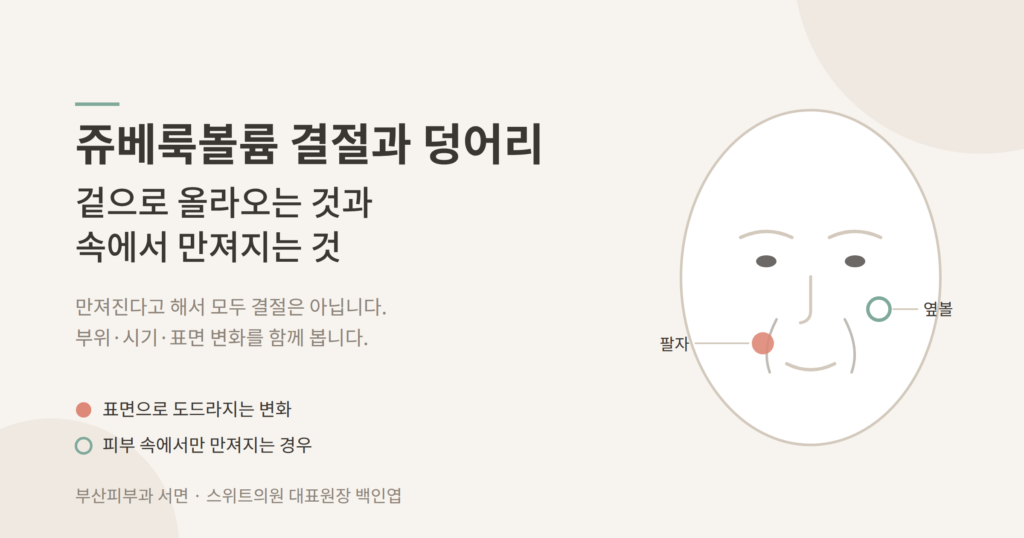 쥬베룩볼륨 결절과 덩어리 구분 개념도 - 팔자 옆볼