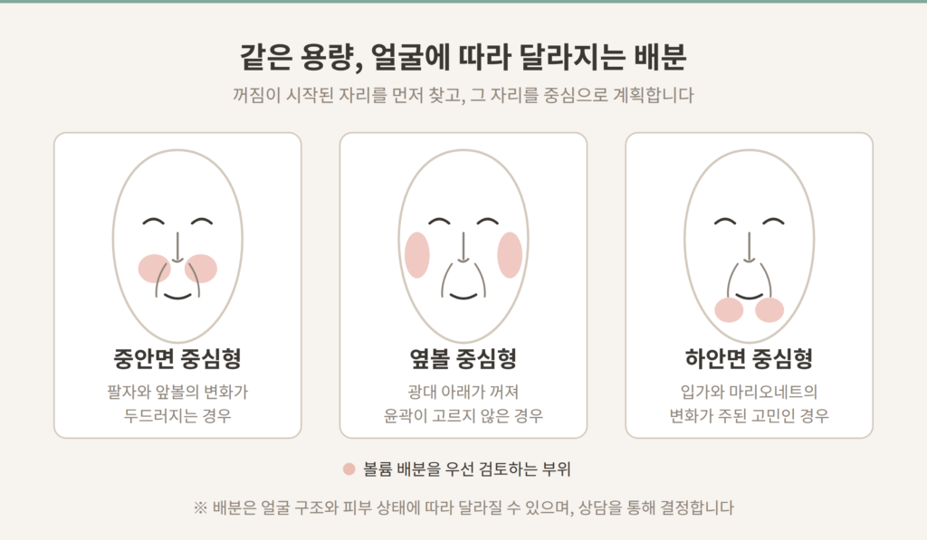 레디어스 배분 유형 중안면 중심형 옆볼 중심형 하안면 중심형 개념도