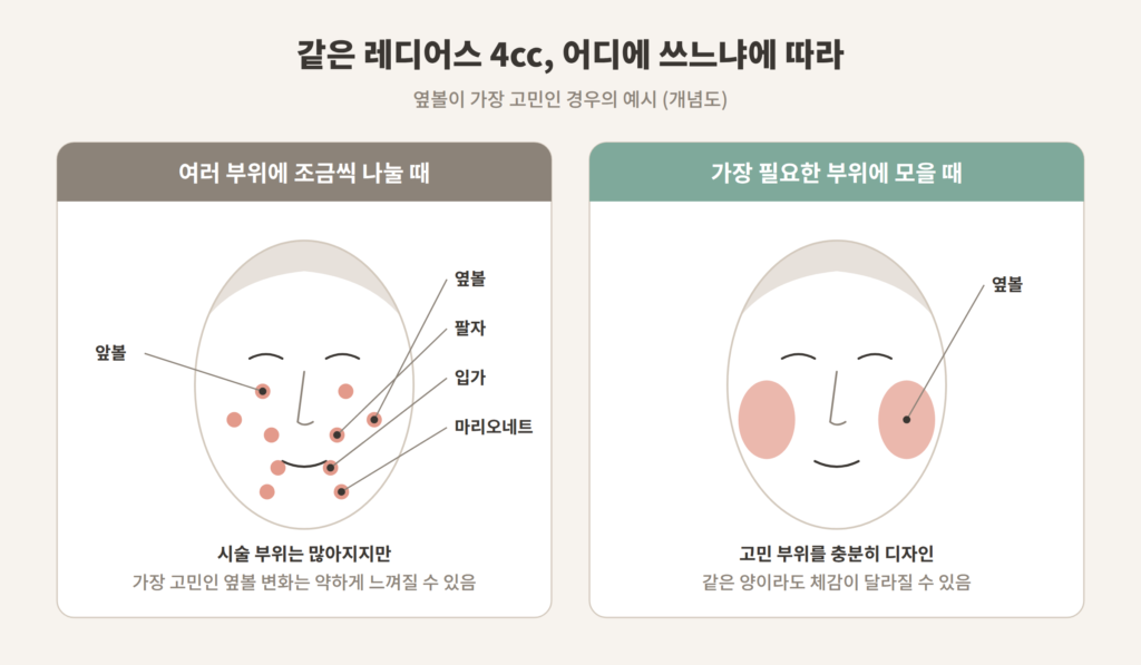 레디어스 4cc 여러 부위 분산과 옆볼 집중 배분 비교 개념도