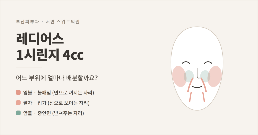 부산 레디어스 1시린지 4cc 얼굴 부위별 배분 개념도