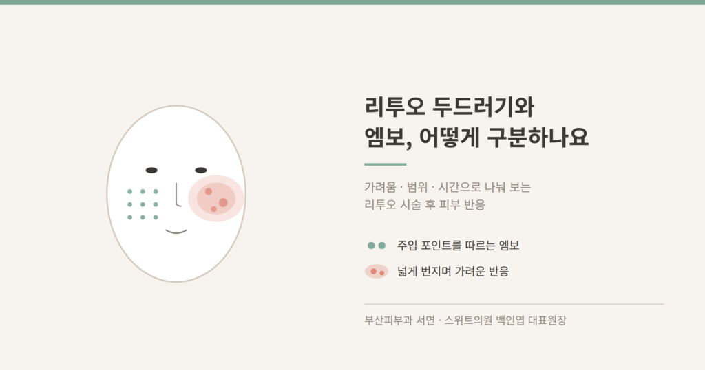 리투오 두드러기와 엠보 구분 개념도