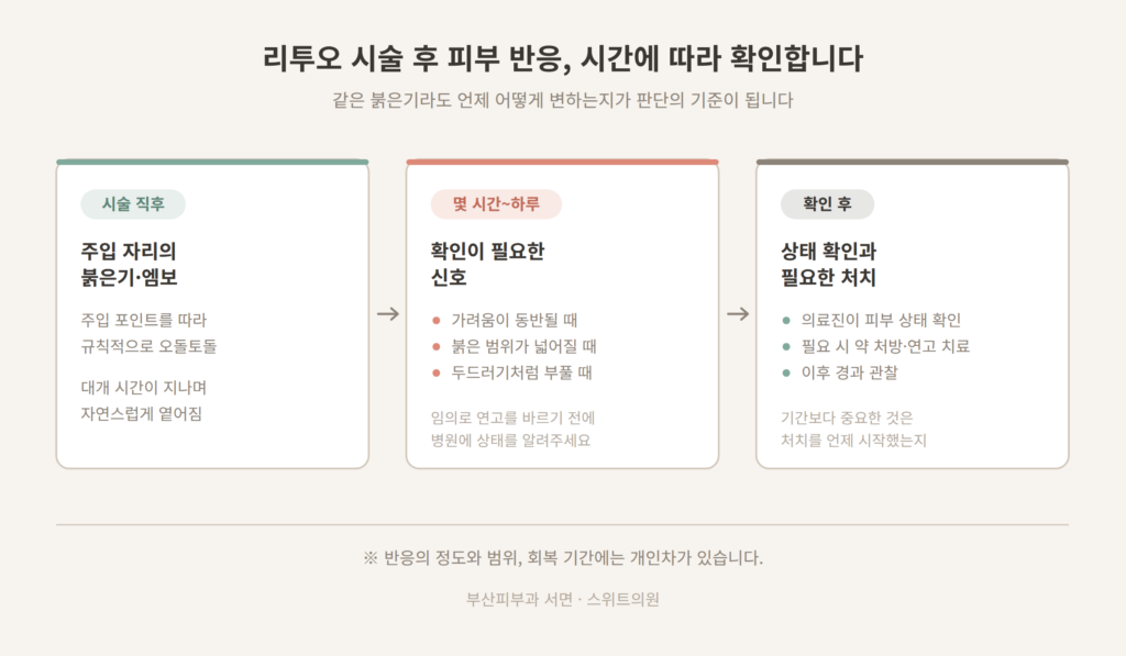 리투오 시술 후 시간에 따른 피부 반응 확인 단계 도식