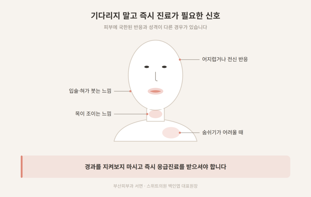 리투오 알러지 즉시 응급진료가 필요한 신호 개념도