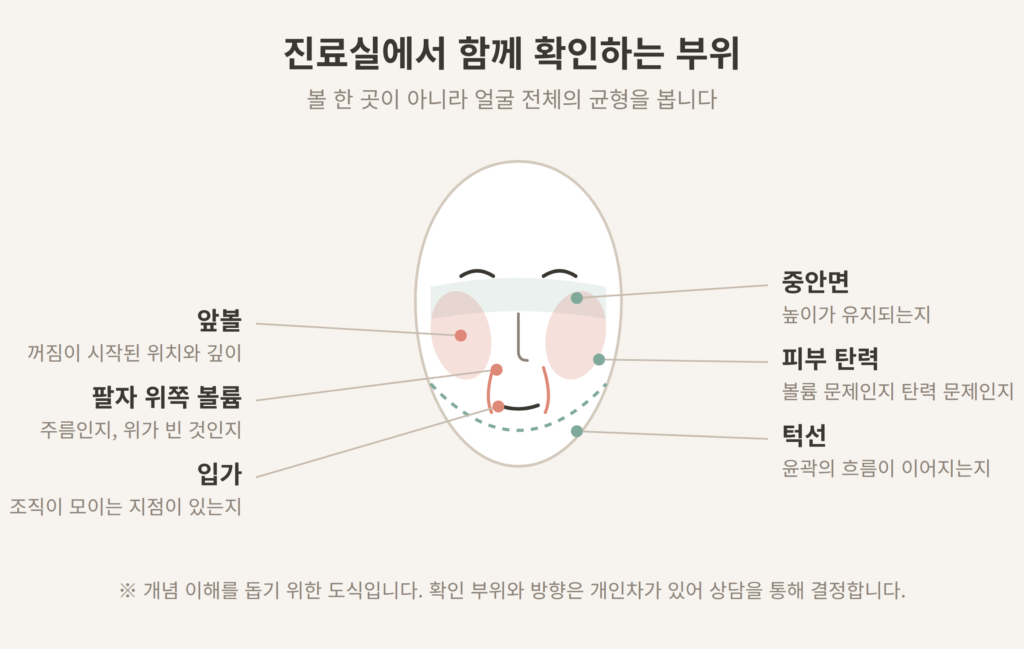볼패임 진료 시 확인 부위 앞볼 중안면 팔자 입가 턱선 개념도