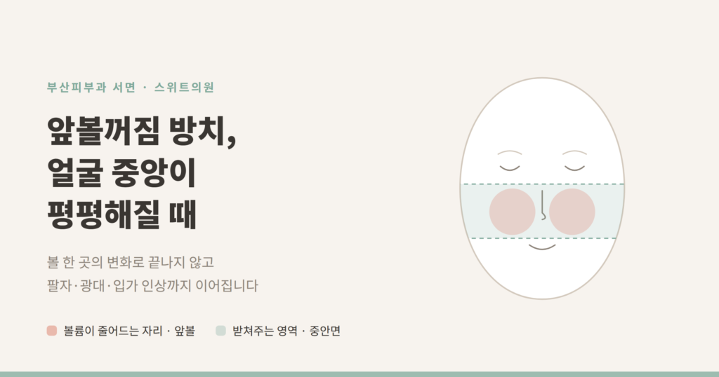 앞볼꺼짐 방치 얼굴 중앙 볼륨 감소 개념도