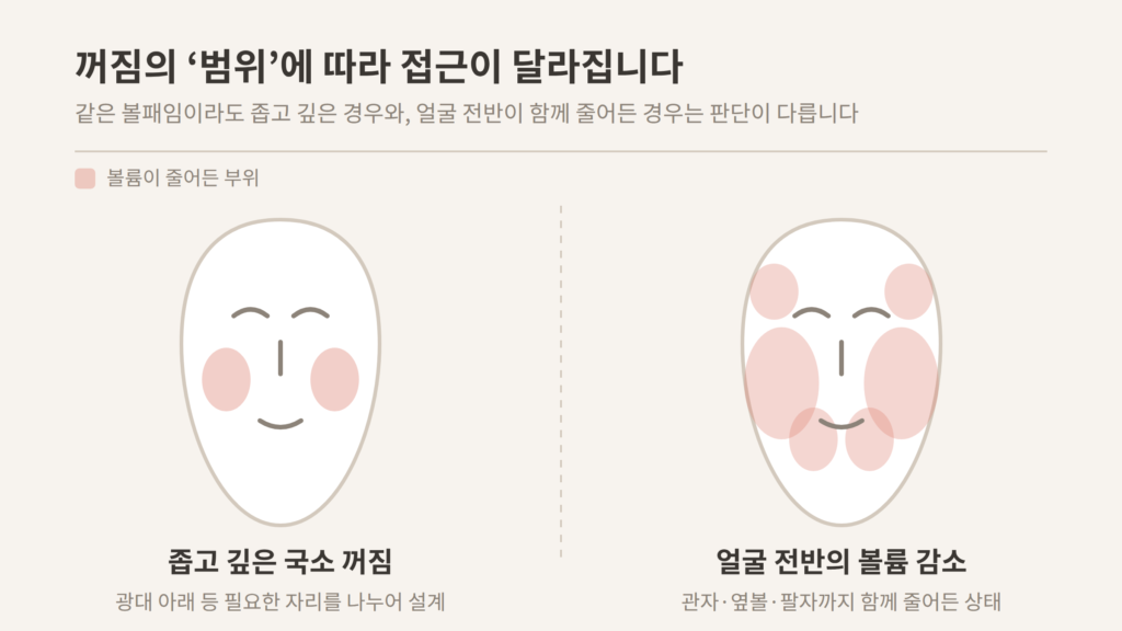 볼패임 국소 꺼짐과 얼굴 전반 볼륨 감소 비교 개념도