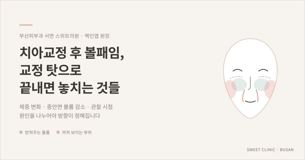 치아교정 후 볼패임 앞볼 중안면 볼륨 감소 개념도