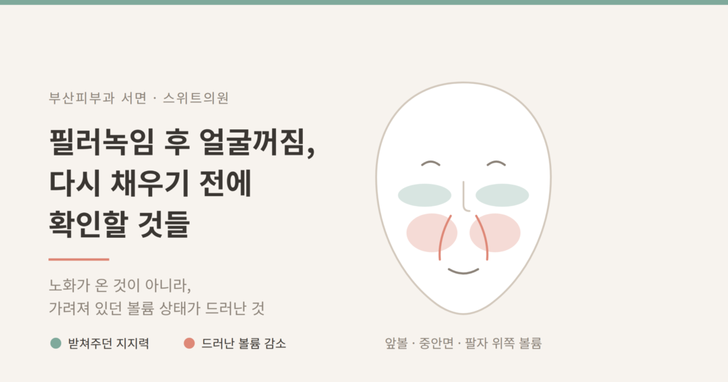 필러녹임 후 얼굴꺼짐 앞볼 중안면 볼륨 개념도