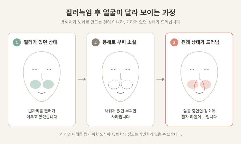 필러 용해 후 볼륨 감소가 드러나는 3단계 과정 도식