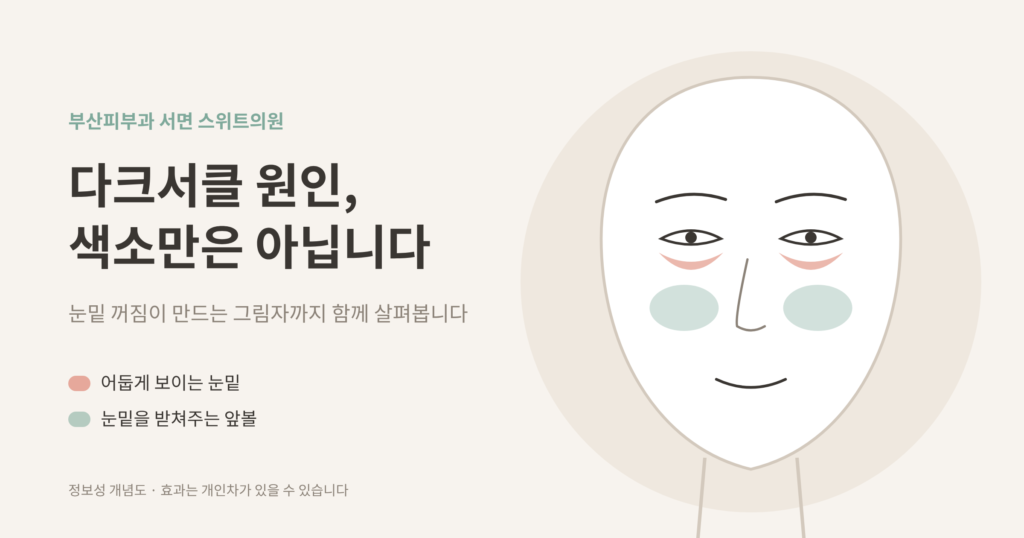 다크서클 원인 눈밑 꺼짐 앞볼 개념도