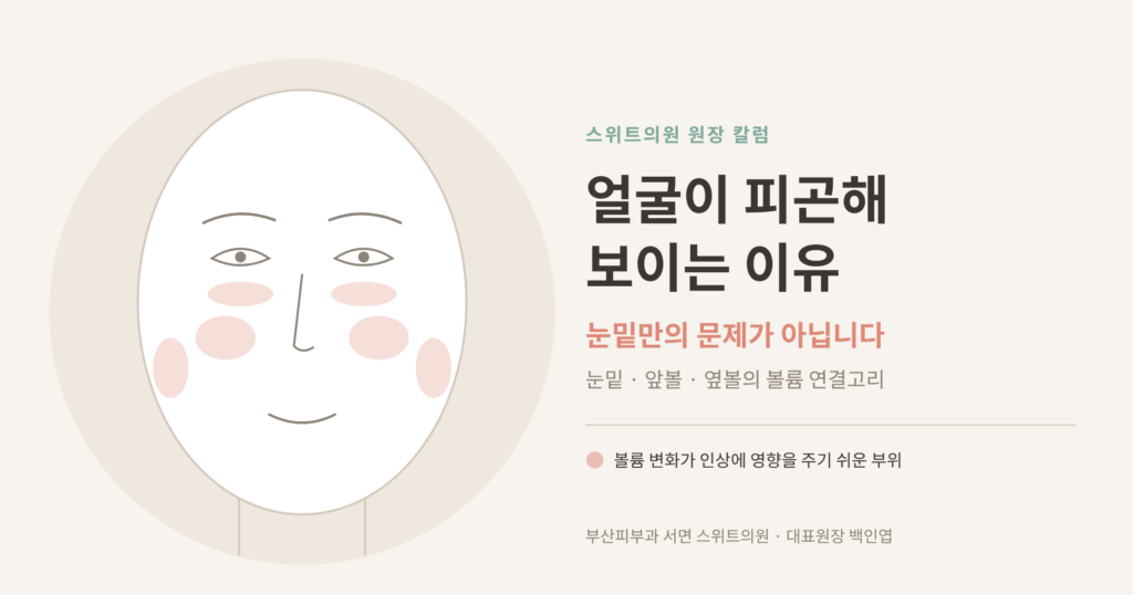 얼굴이 피곤해 보이는 이유 얼굴 볼륨 꺼짐 눈밑 앞볼 옆볼 개념도