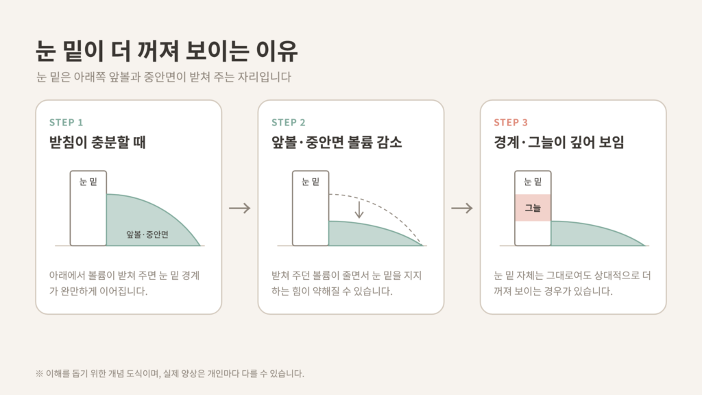 눈밑꺼짐 원인 앞볼 중안면 볼륨 감소 3단계 개념도