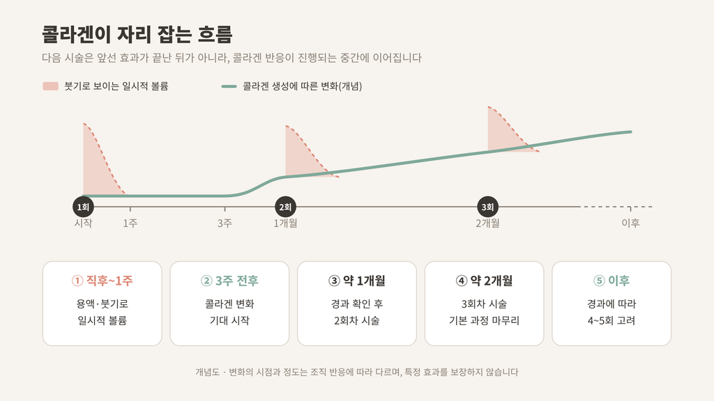 쥬베룩볼륨 횟수 한 달 간격 3회 콜라겐 생성 흐름 개념도