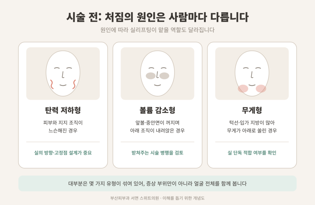 실리프팅 시술 전 처짐 유형 탄력 저하형 볼륨 감소형 무게형