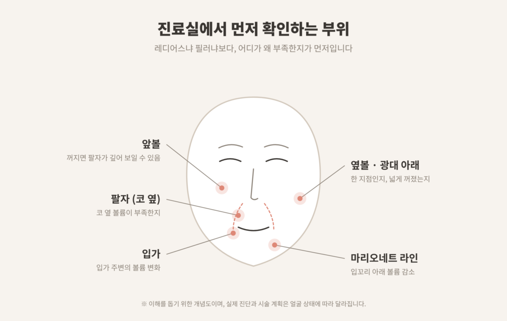 볼패임 팔자주름 레디어스 필러 선택 전 확인 부위 앞볼 옆볼 입가 마리오네트 개념도