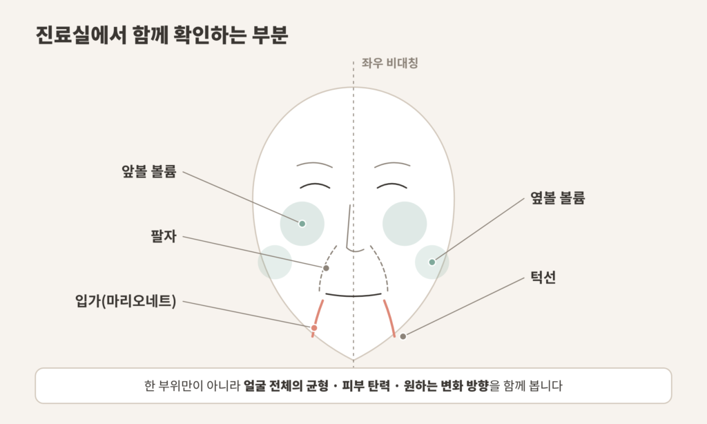 마리오네트 주름 상담 시 확인하는 앞볼 옆볼 팔자 입가 턱선 도식