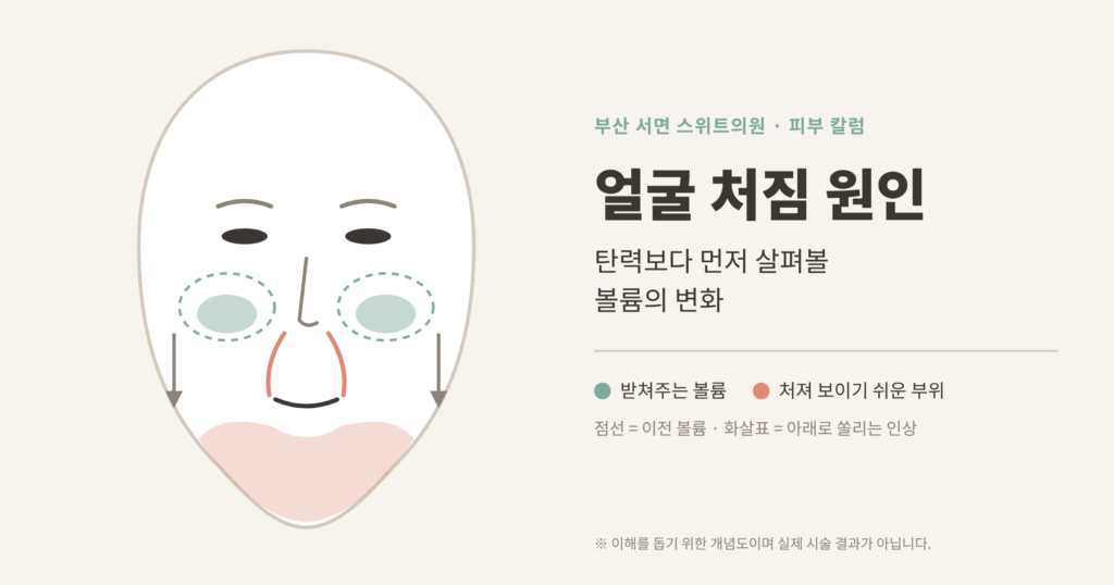 얼굴 처짐 원인 탄력과 볼륨 변화 개념도