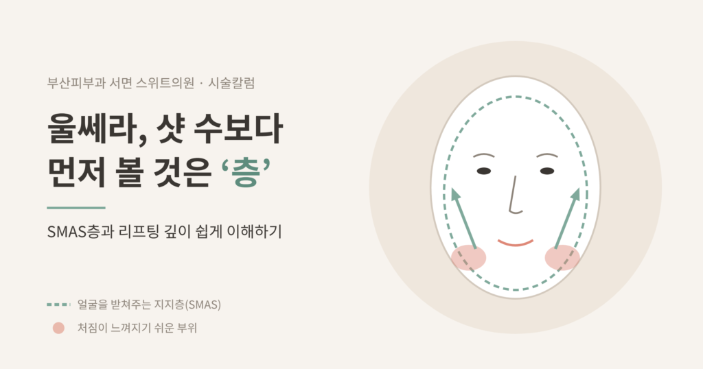 부산 울쎄라 리프팅 SMAS층 개념도