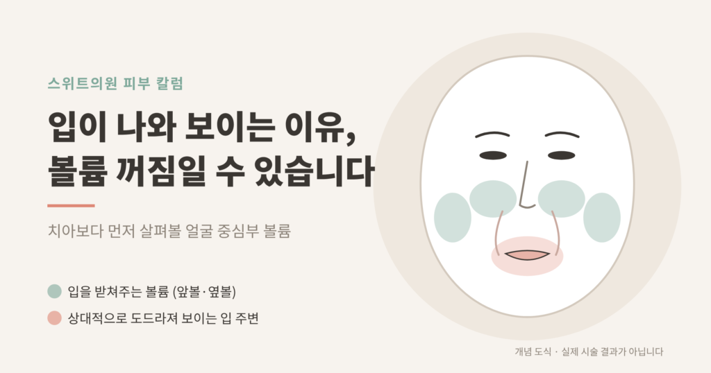 입 돌출 원인 중안면 볼륨 꺼짐 개념도