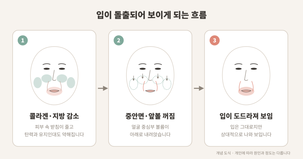 중안면 볼륨 꺼짐으로 입이 돌출되어 보이는 과정