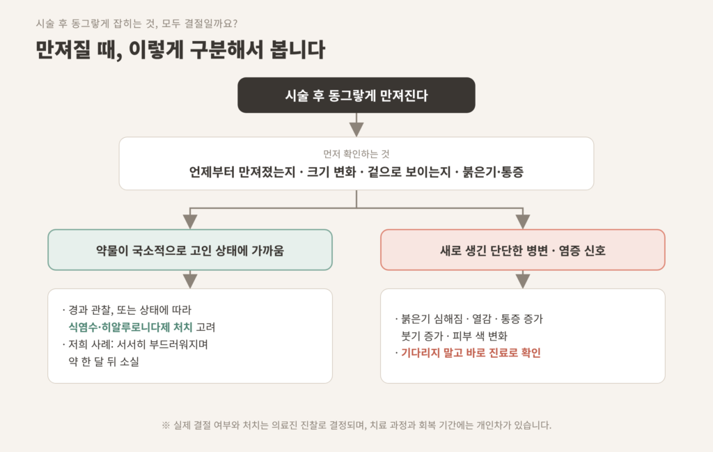 쥬베룩볼륨 뭉침 결절 구분 히알루로니다제 처치 흐름도