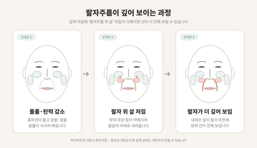 팔자주름 위 살 처짐으로 팔자주름이 깊어 보이는 과정 3단계