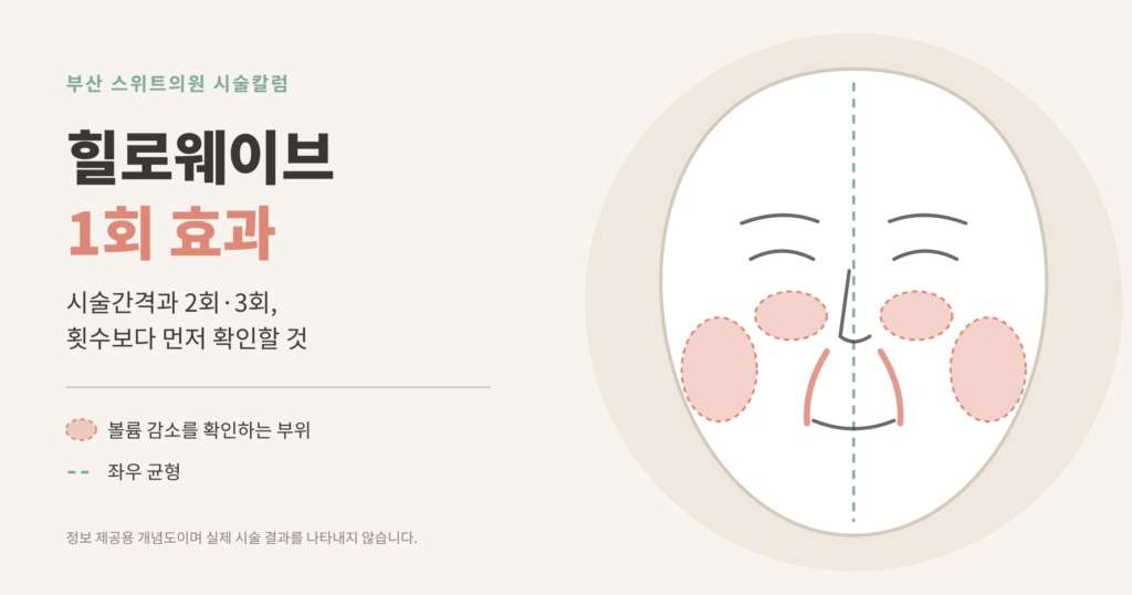 힐로웨이브 1회 효과 시술간격 볼륨 감소 확인 부위 개념도
