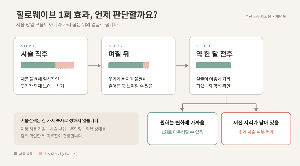 힐로웨이브 시술 전 앞볼 옆볼 팔자 확인 부위 개념도
